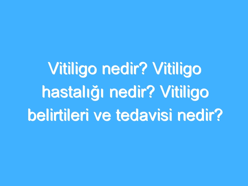 Vitiligo nedir? Vitiligo hastalığı nedir? Vitiligo belirtileri ve tedavisi nedir?